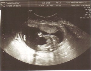 2012-08-bébé2-écho